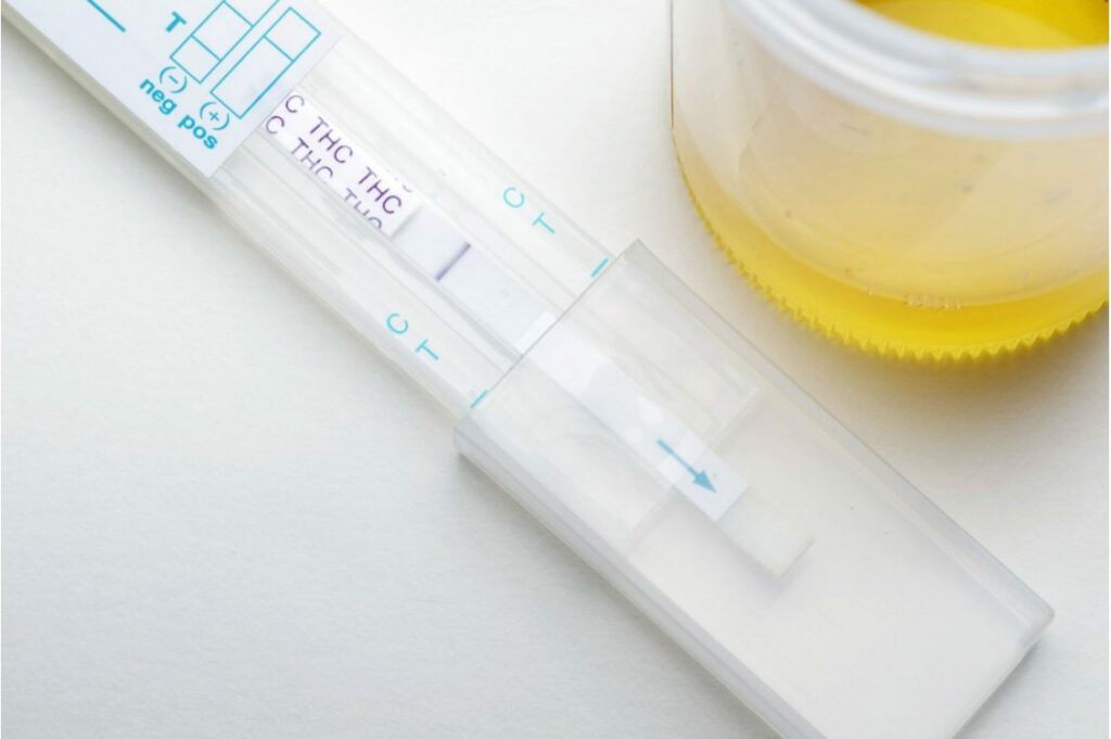 THC drug urine test